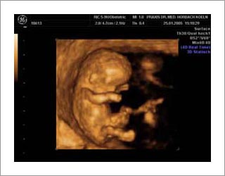 Igel Individuelle Gesundheitsleistungen Schwangerschaft Ultraschall Untersuchungen 3d 4d Ultraschall